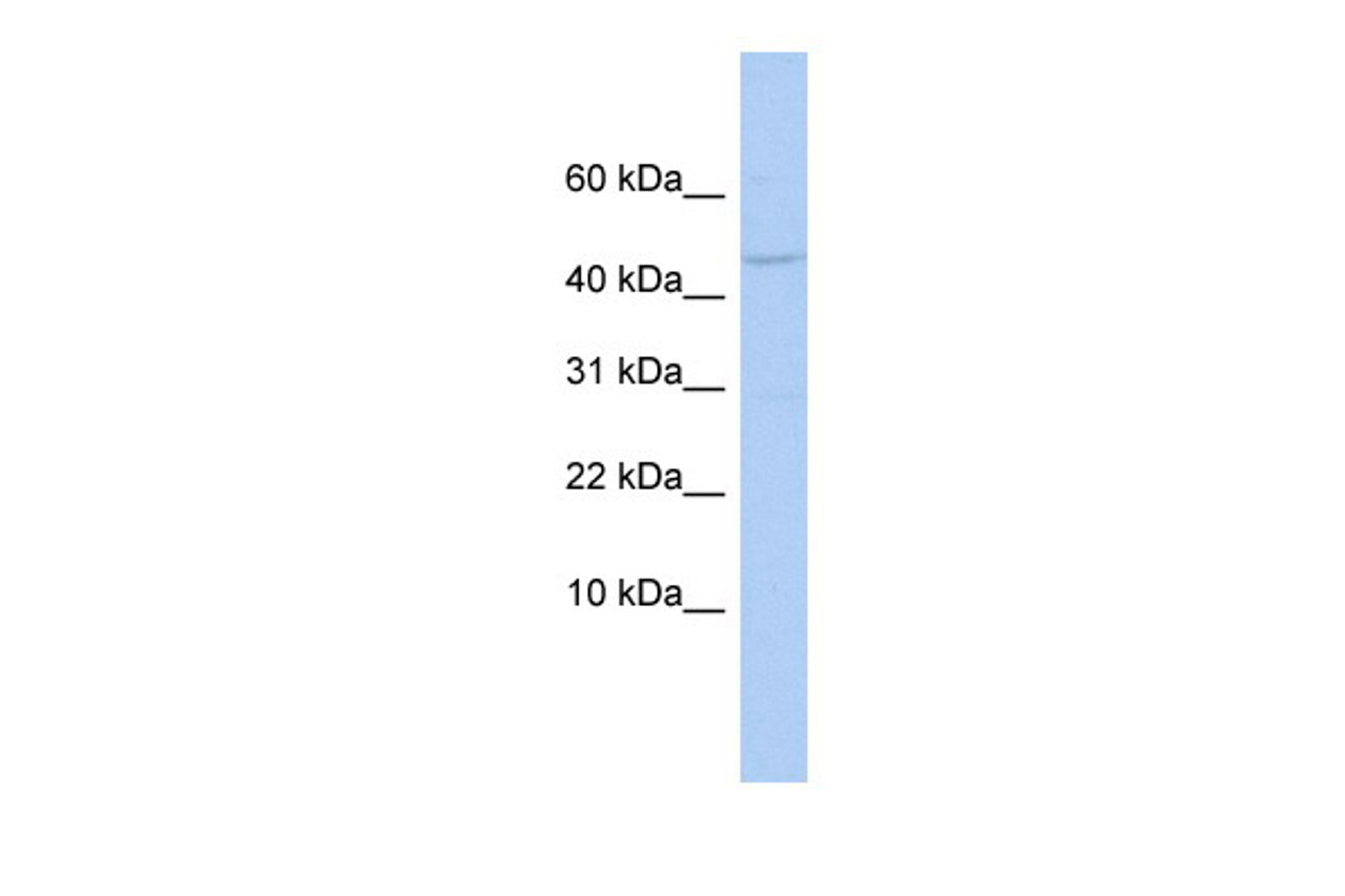 Antibody used in WB on Human OVCAR-3 at 0.2-1 ug/ml.