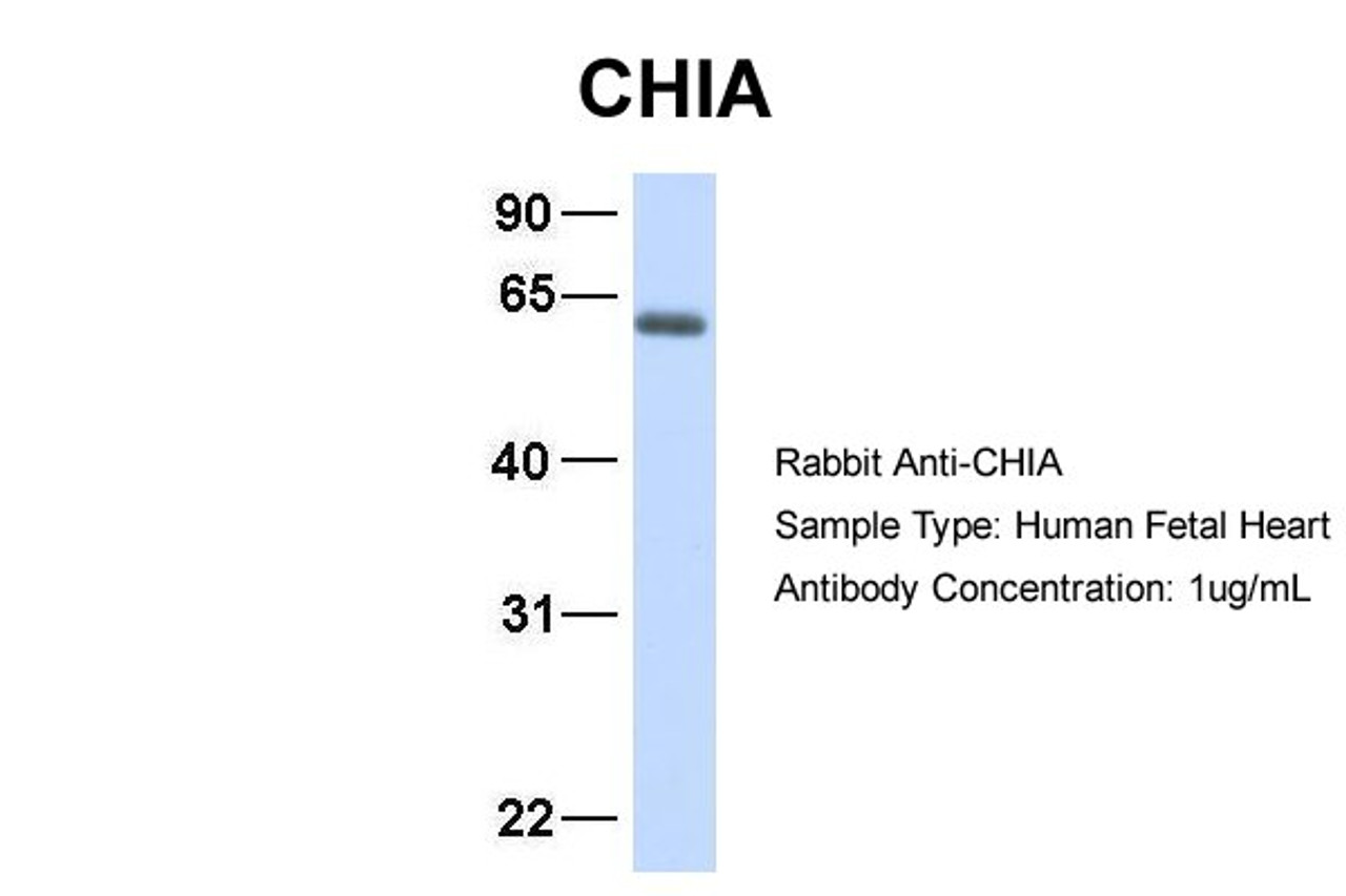 Antibody used in WB on Hum. Fetal Heart at 1 ug/ml.