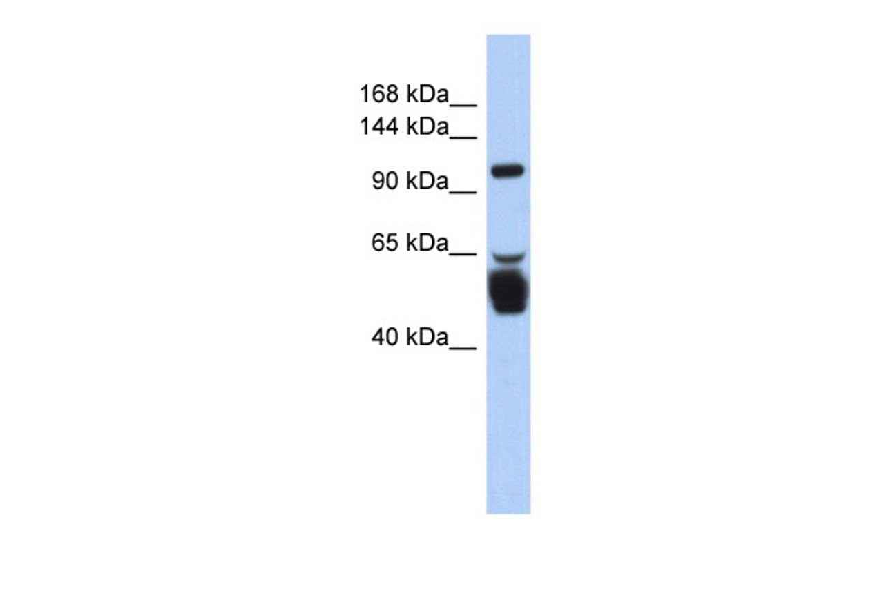 Antibody used in WB on Human Stomach at 0.2-1 ug/ml.