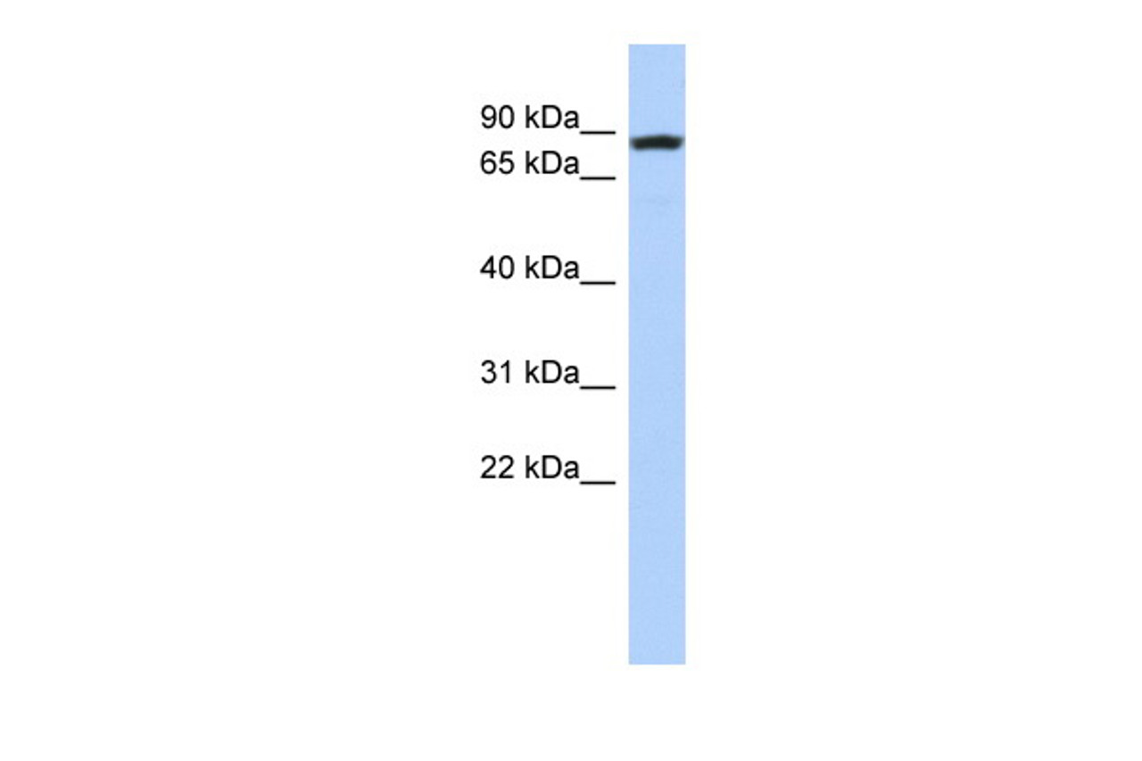 Antibody used in WB on Human MCF7 cells at 0.2-1 ug/ml.