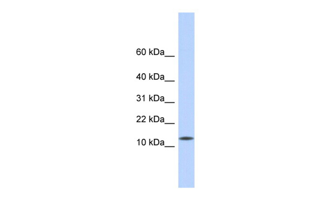 Antibody used in WB on Human Heart at 0.2-1 ug/ml.