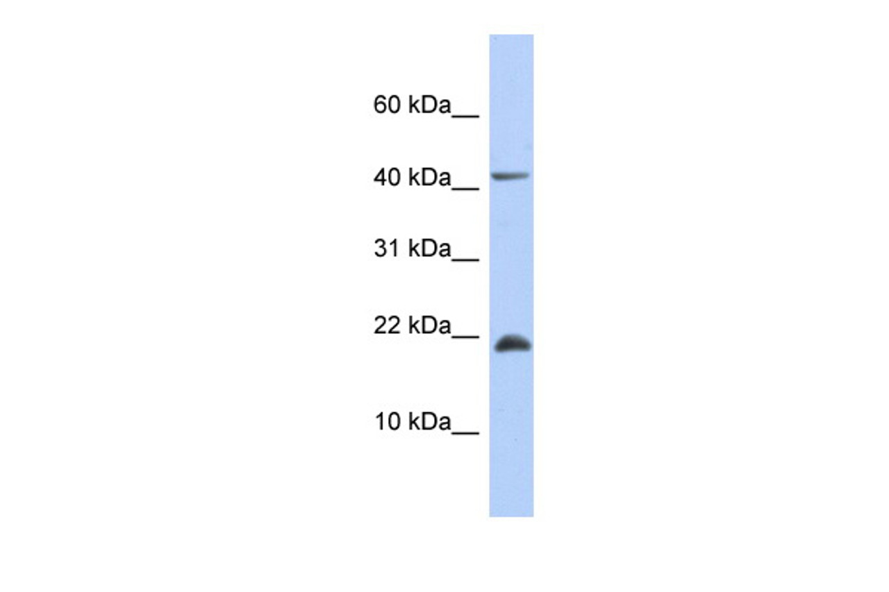 Antibody used in WB on Human Muscle at 0.2-1 ug/ml.