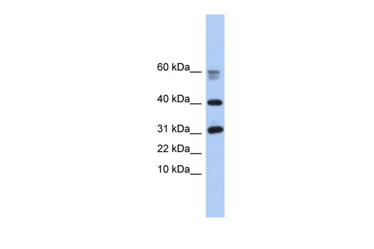 Antibody used in WB on Human Placenta at 0.2-1 ug/ml.