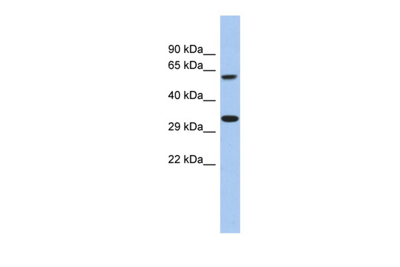 Antibody used in WB on Human Liver at 0.2-1 ug/ml.