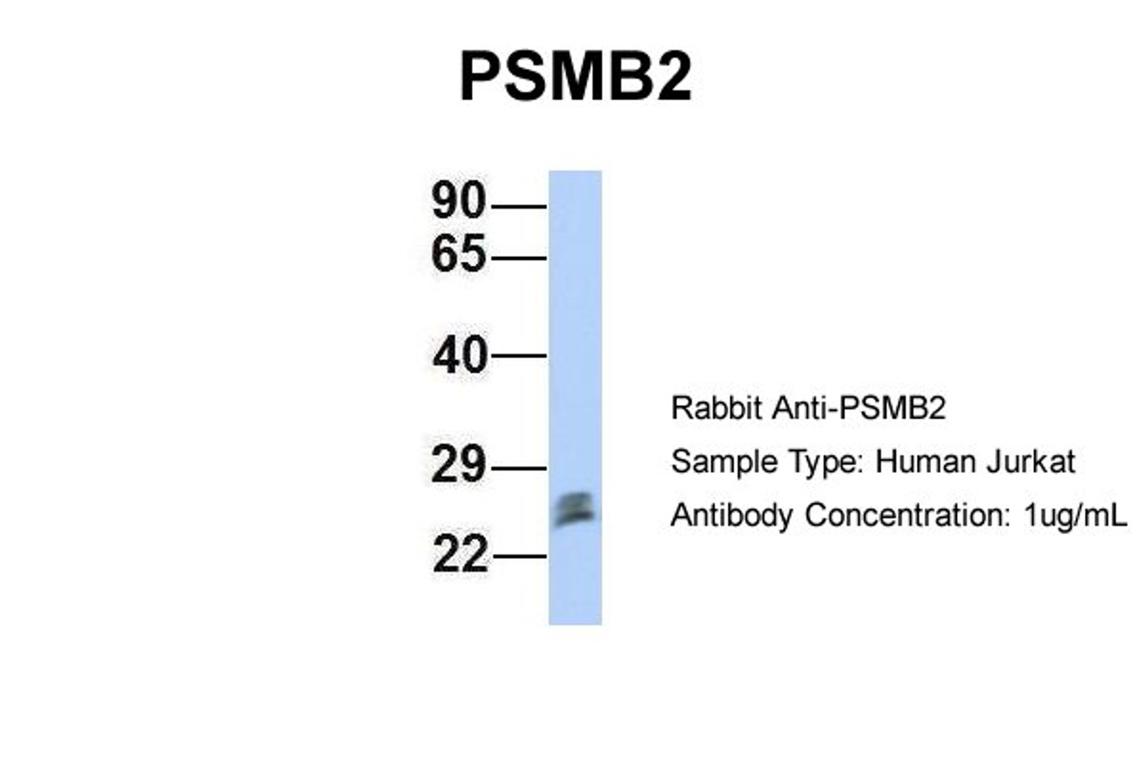 Antibody used in WB on Human Jurkat 1 ug/ml.