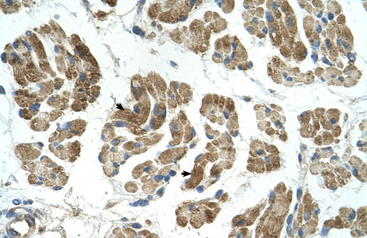 Antibody used in IHC on Human Muscle at 4.0-8.0 ug/ml.