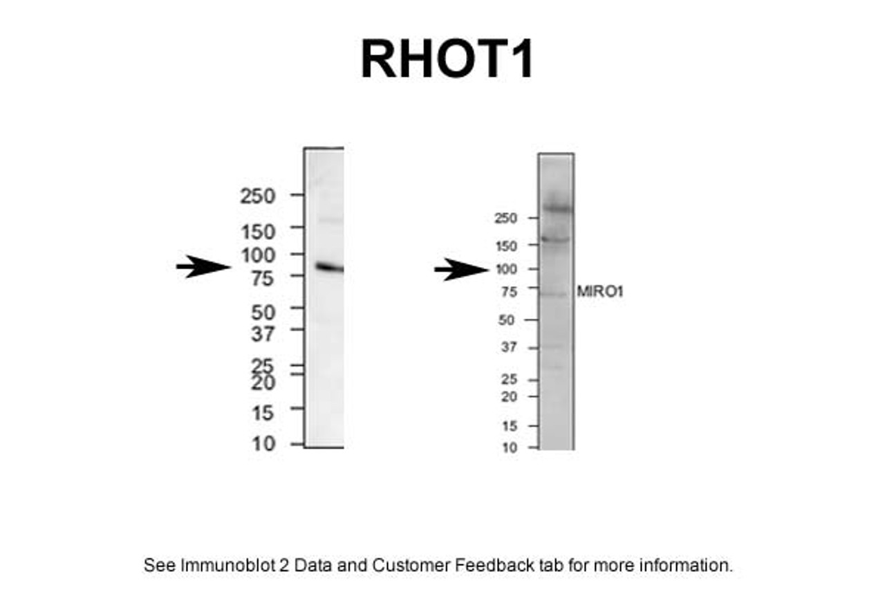 Antibody used in WB on mouse brain and human neuroblastoma.