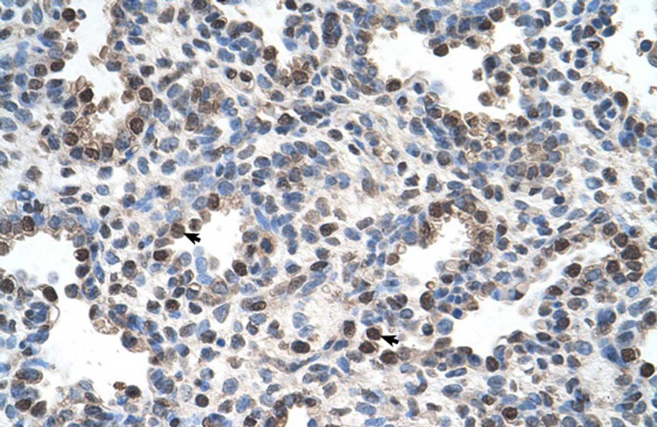 Antibody used in IHC on Human Lung.