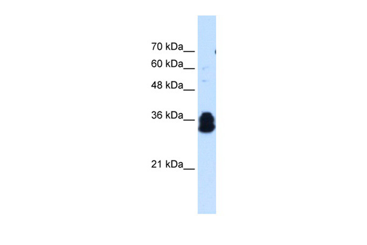 Antibody used in WB on Human Jurkat 0.625 ug/ml.