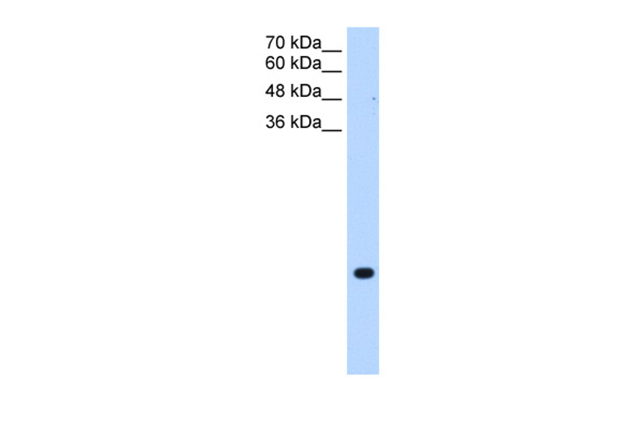 Antibody used in WB on Human Jurkat 0.2-1 ug/ml.