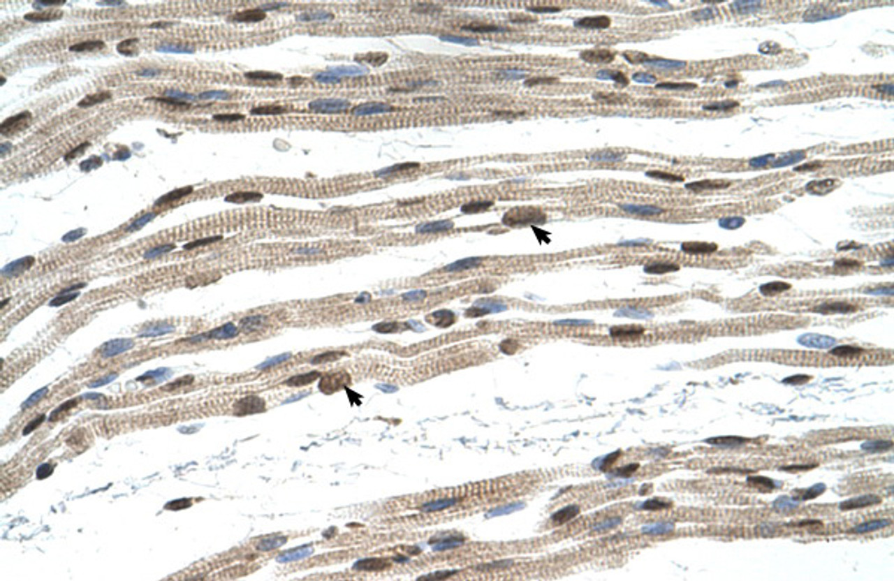 Antibody used in IHC on Human Muscle.