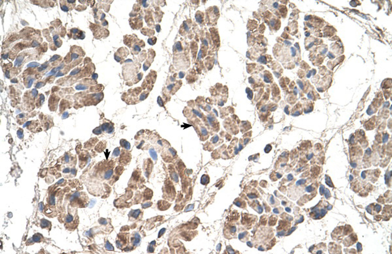 Antibody used in IHC on Human Muscle.