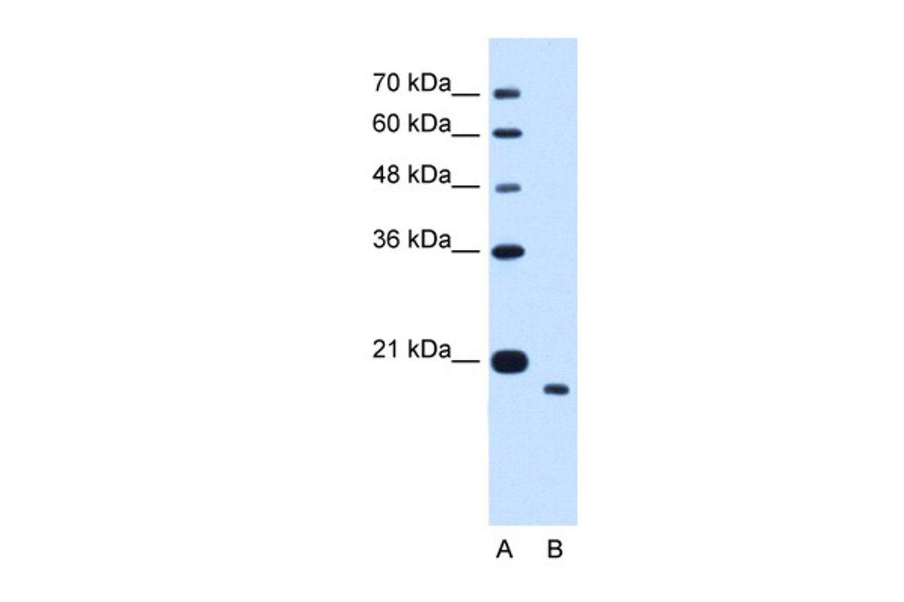 Antibody used in WB on Human HepG2 at 1.25 ug/ml.