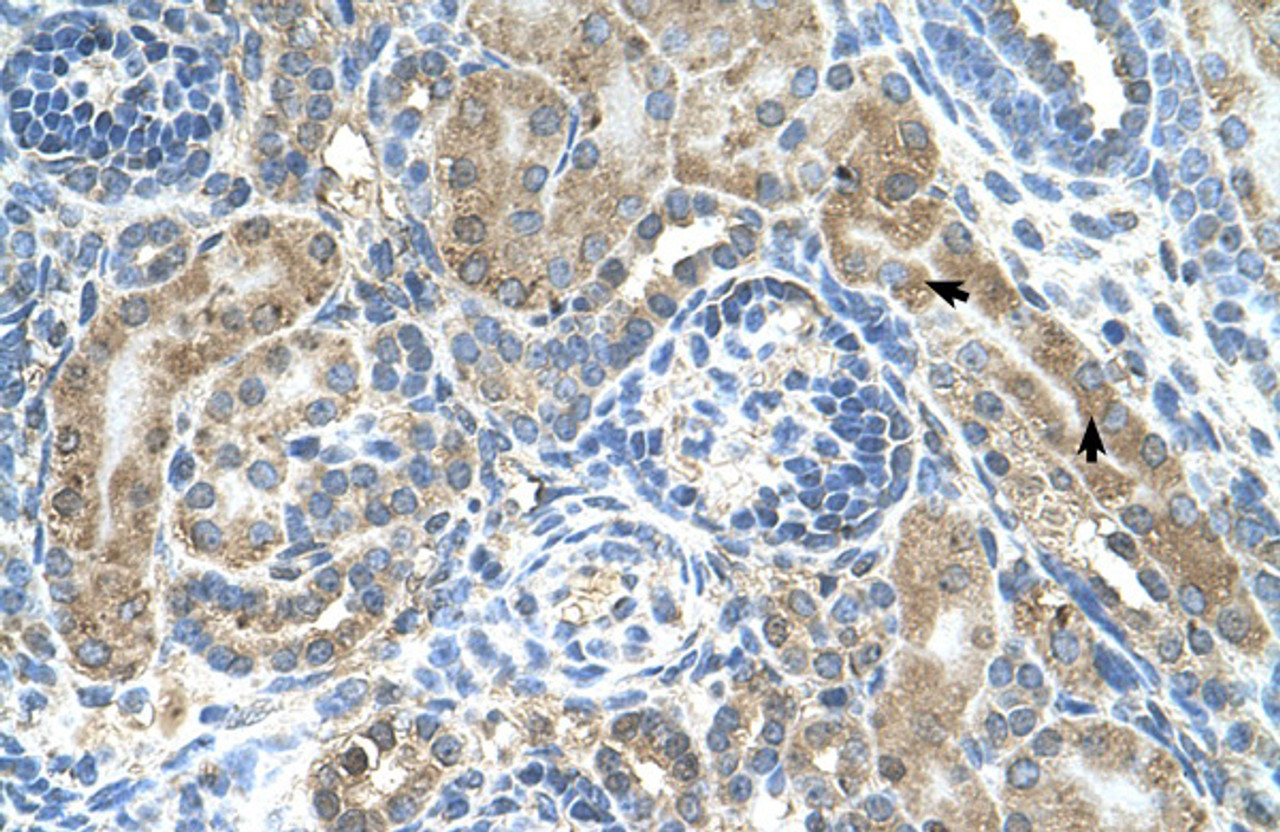 Antibody used in IHC on Human kidney.