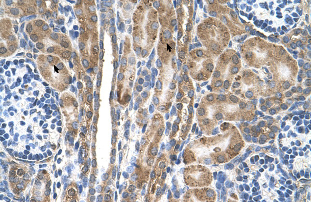 Antibody used in IHC on Human kidney.