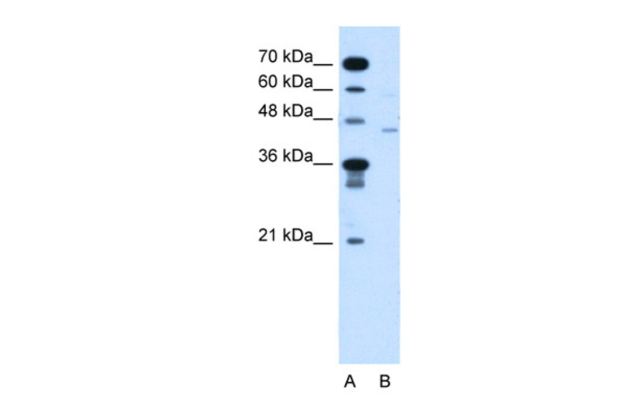 Antibody used in WB on Human Jurkat 5.0 ug/ml.