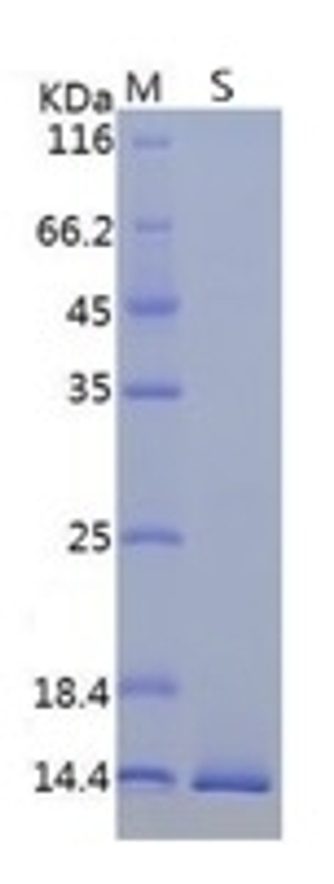 SARS-CoV-2 (COVID-19, 2019-nCoV) ORF8 Recombinant Protein, His Tag on SDS-PAGE under reducing (R) condition. The gel was stained overnight with Coomassie Blue. The purity of the protein is greater than 80%.