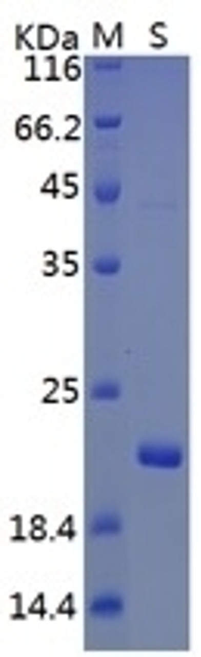 SARS-CoV-2 (COVID-19, 2019-nCoV) ORF3a Recombinant Protein, His Tag on SDS-PAGE under reducing (R) condition. The gel was stained overnight with Coomassie Blue. The purity of the protein is greater than 80%.
