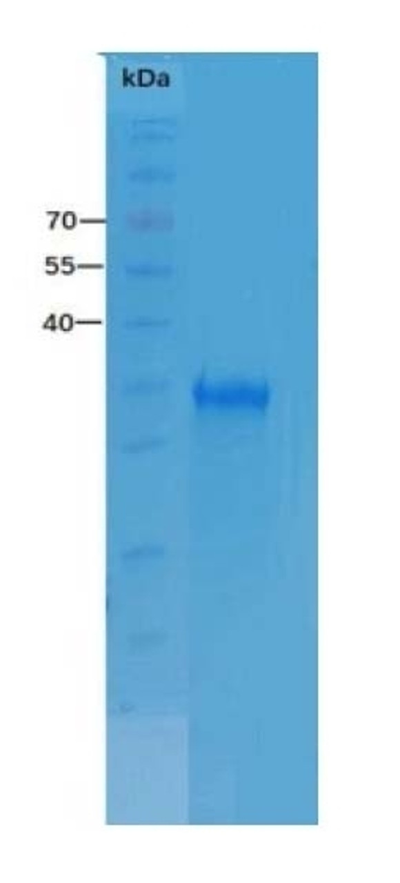 SARS-CoV-2 (COVID-19, 2019-nCoV) Spike-RBD Recombinant Protein, His Tag on SDS-PAGE under reducing (R) condition. The gel was stained overnight with Coomassie Blue. The purity of the protein is greater than 90%.