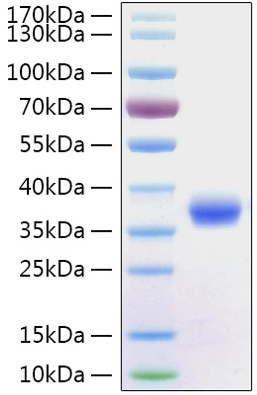 SARS-CoV-2 (COVID-19) spike RBD recombinant protein was determined by SDS-PAGE with Coomassie Blue, showing a band at 36 kDa.