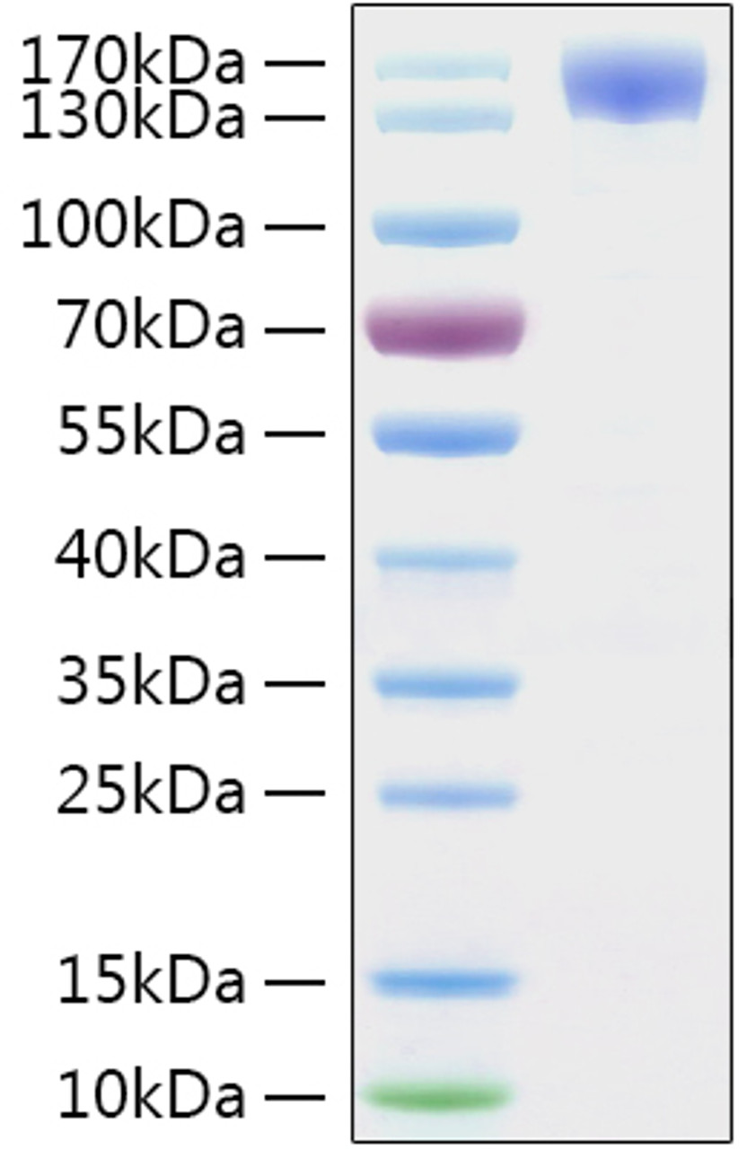 SARS-CoV-2 (COVID-19) spike S1 recombinant protein was determined by SDS-PAGE with Coomassie Blue, showing a band at 130-160 kDa.