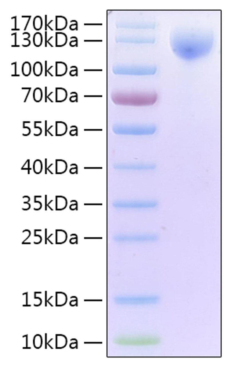 SARS-CoV-2 (COVID-19) spike S1 recombinant protein on Tris-Bis PAGE under reduced condition. The purity is greater than 95%.