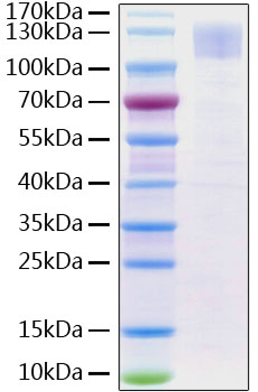 SARS-CoV-2 (COVID-19) spike S1 recombinant protein was determined by SDS-PAGE with Coomassie Blue, showing a band at 110-130 kDa.
