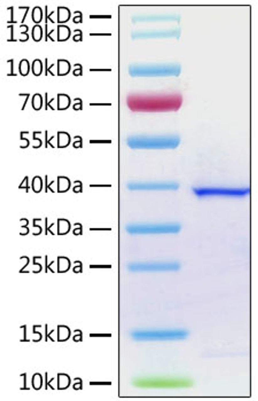 SARS-CoV-2 (COVID-19) papain-like protease was determined by SDS-PAGE with Coomassie Blue, showing a band at 38 kDa.