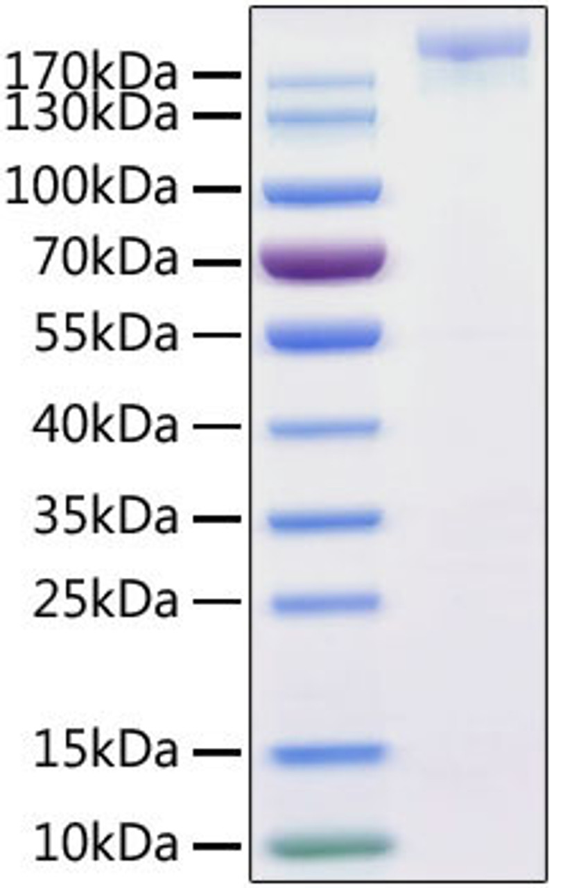 SARS-CoV-2 (COVID-19) S1+S2 ECD (S-ECD) recombinant protein was determined by SDS-PAGE with Coomassie Blue, showing a band at 170-220 kDa.