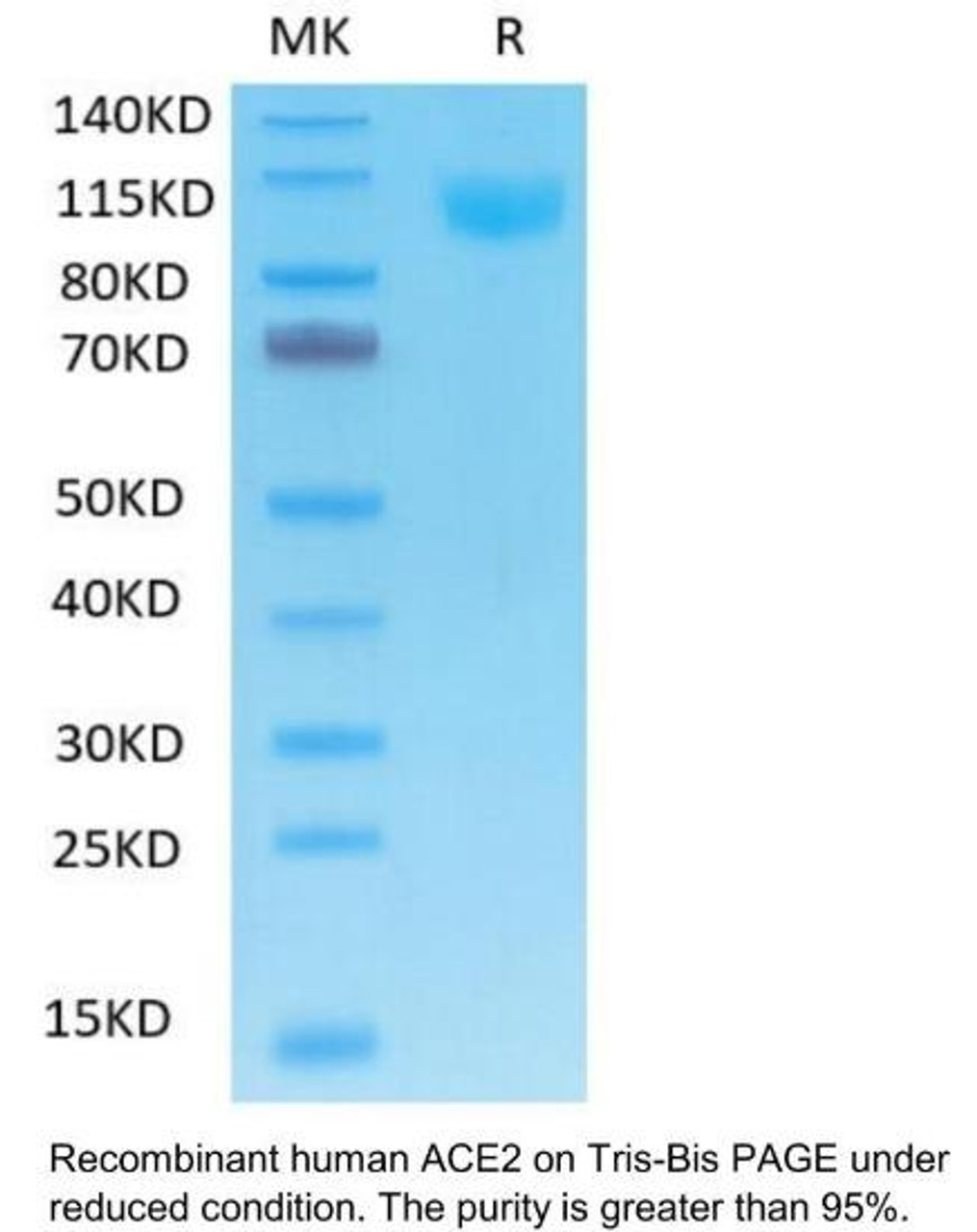 Human ACE2 Recombinant Protein | 10-200