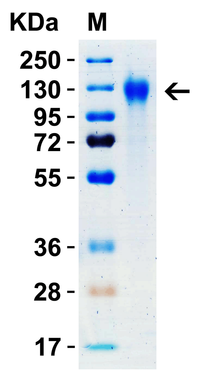 SDS-PAGE Validation with SARS-CoV-2 (COVID-19) Spike S1 Recombinant Protein : 1 ;g SARS-CoV-2 (COVID-19) Spike S1 recombinant protein, 10-300. Observed: 125kD