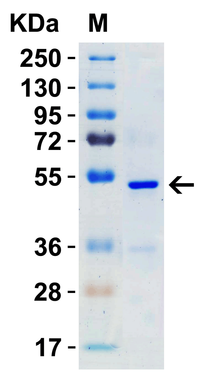 SDS-PAGE Validation with SARS-CoV-2 (COVID-19) Nucleocapsid Recombinant Protein : 1 ;g SARS-CoV-2 (COVID-19) Nucleocapsid recombinant protein, 10-306. Observed: 50kD