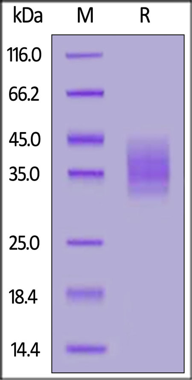 Rat CLEC12A, His Tag on SDS-PAGE under reducing (R) condition. The gel was stained overnight with Coomassie Blue. The purity of the protein is greater than 90%.