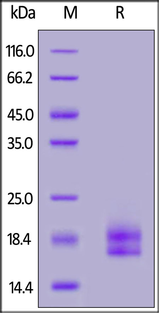 Human PD-L1 (19-134) , His Tag on SDS-PAGE under reducing (R) condition. The gel was stained overnight with Coomassie Blue. The purity of the protein is greater than 95%.