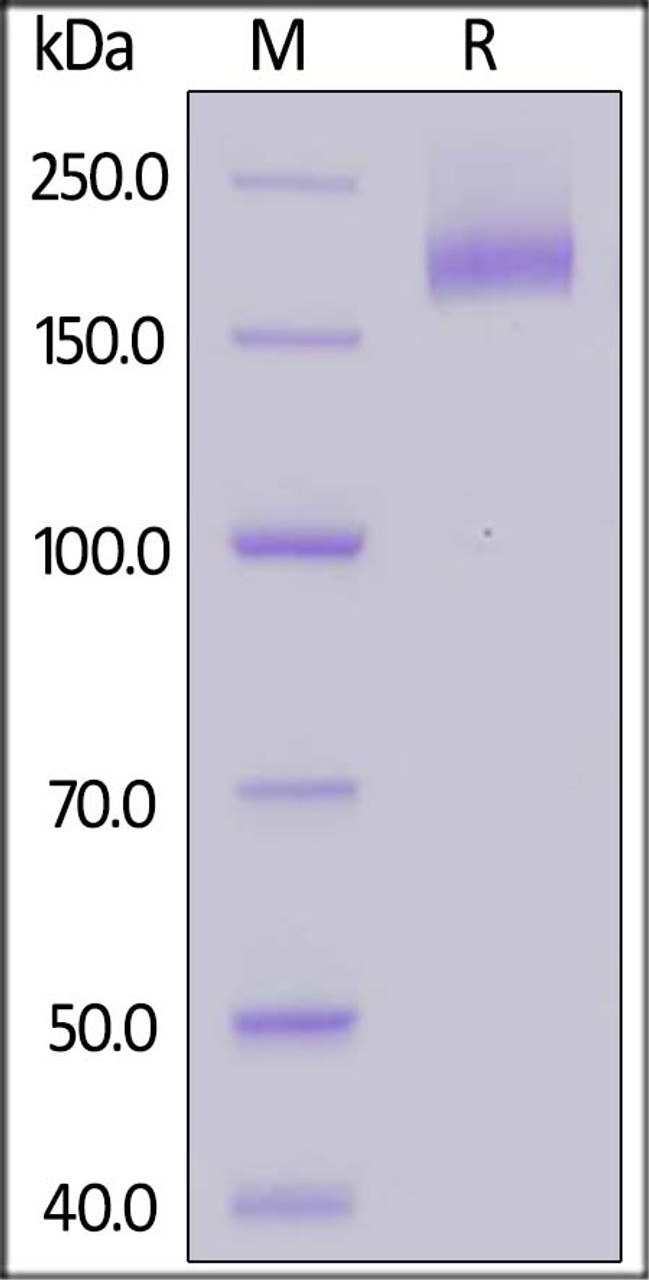 SARS S protein (R667A, K968P, V969P) , His Tag on SDS-PAGE under reducing (R) condition. The gel was stained overnight with Coomassie Blue. The purity of the protein is greater than 95%.