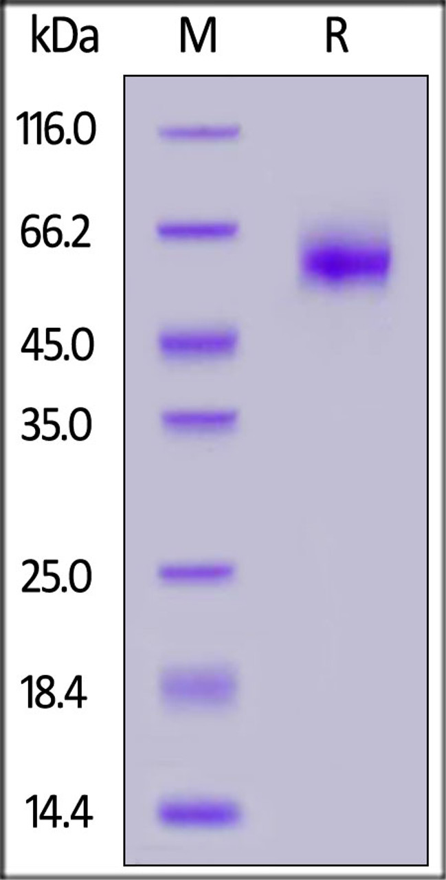Human IL-1 Rrp2 (C154S, C262S) , His Tag on SDS-PAGE under reducing (R) condition. The gel was stained overnight with Coomassie Blue. The purity of the protein is greater than 95%.
