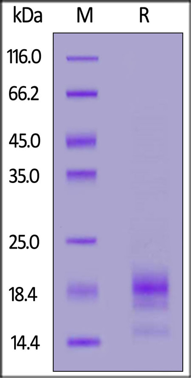 Rabbit IL-5, His Tag on SDS-PAGE under reducing (R) condition. The gel was stained overnight with Coomassie Blue. The purity of the protein is greater than 90%.