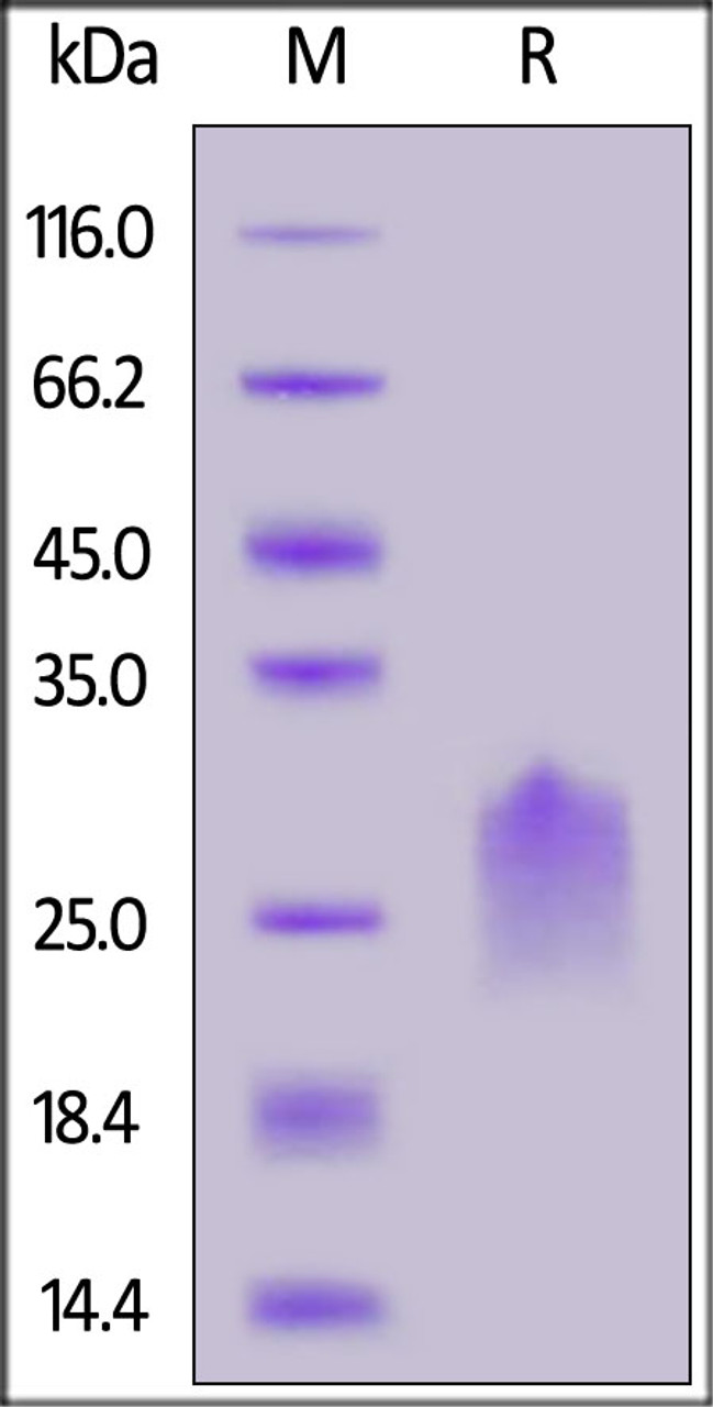 Human PVRIG, His Tag on SDS-PAGE under reducing (R) condition. The gel was stained overnight with Coomassie Blue. The purity of the protein is greater than 90%.