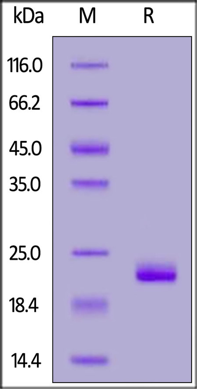 Human ZNRF3, His Tag on SDS-PAGE under reducing (R) condition. The gel was stained overnight with Coomassie Blue. The purity of the protein is greater than 95%.