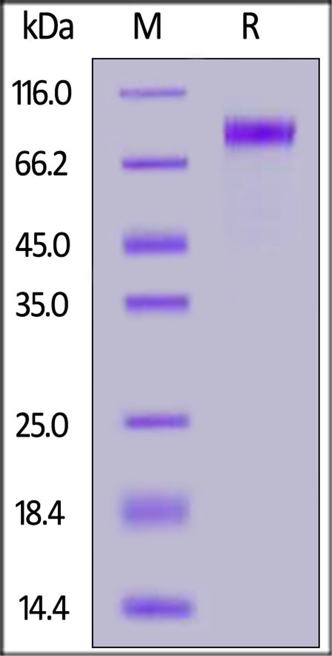 Human LIV-1, Fc Tag on SDS-PAGE under reducing (R) condition. The gel was stained overnight with Coomassie Blue. The purity of the protein is greater than 95%.