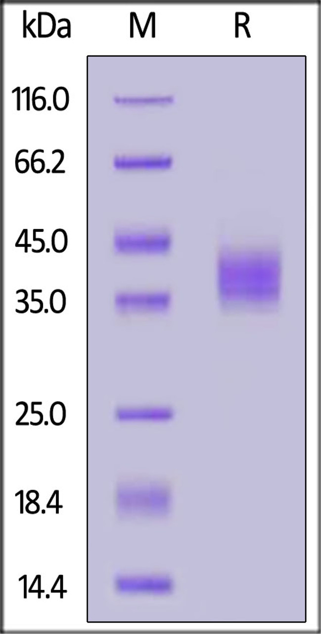 Human Tissue Factor, His Tag on SDS-PAGE under reducing (R) condition. The gel was stained overnight with Coomassie Blue. The purity of the protein is greater than 90%.