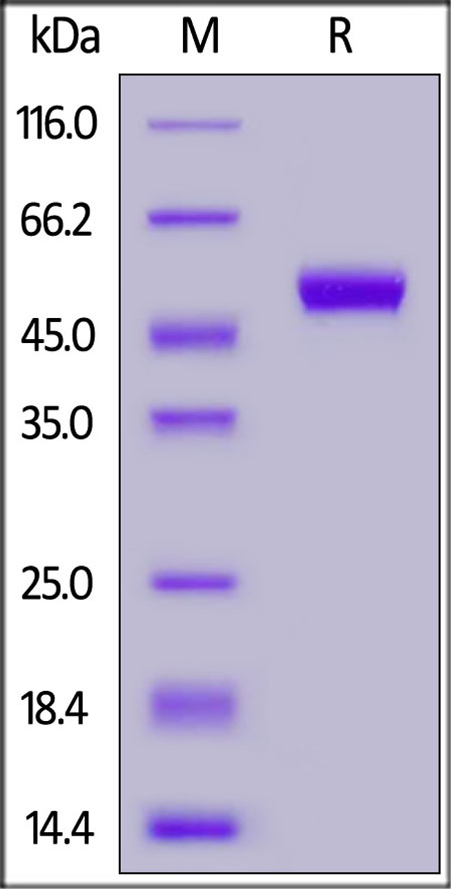 FITC-Labeled Human CD5, His Tag on SDS-PAGE under reducing (R) condition. The gel was stained overnight with Coomassie Blue. The purity of the protein is greater than 95%.