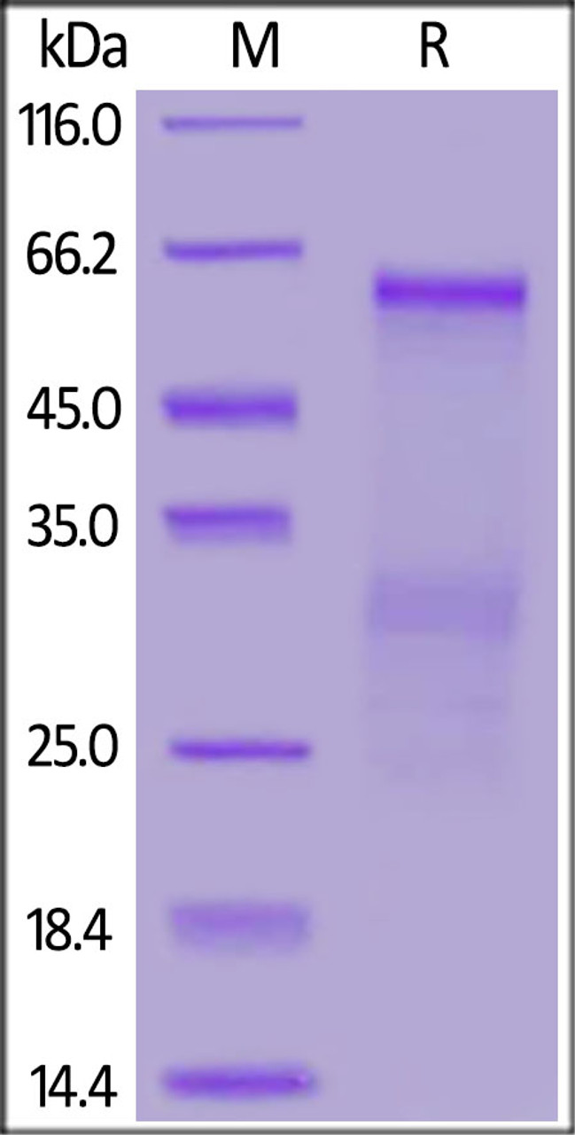 SARS Nucleocapsid protein, His Tag on SDS-PAGE under reducing (R) condition. The gel was stained overnight with Coomassie Blue. The purity of the protein is greater than 90%.