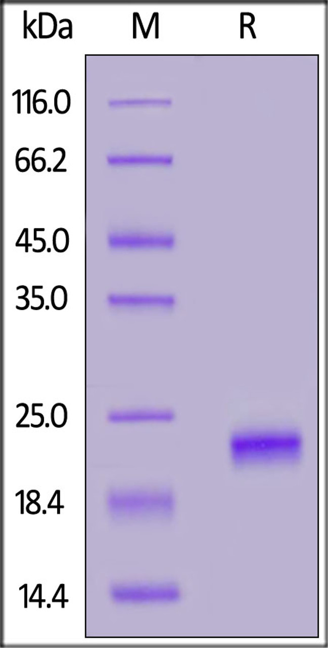 Human IFN-alpha 1, His Tag on SDS-PAGE under reducing (R) condition. The gel was stained overnight with Coomassie Blue. The purity of the protein is greater than 95%.