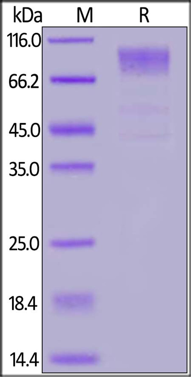 HCoV-229E S1 protein, His Tag on SDS-PAGE under reducing (R) condition. The gel was stained overnight with Coomassie Blue. The purity of the protein is greater than 90%.