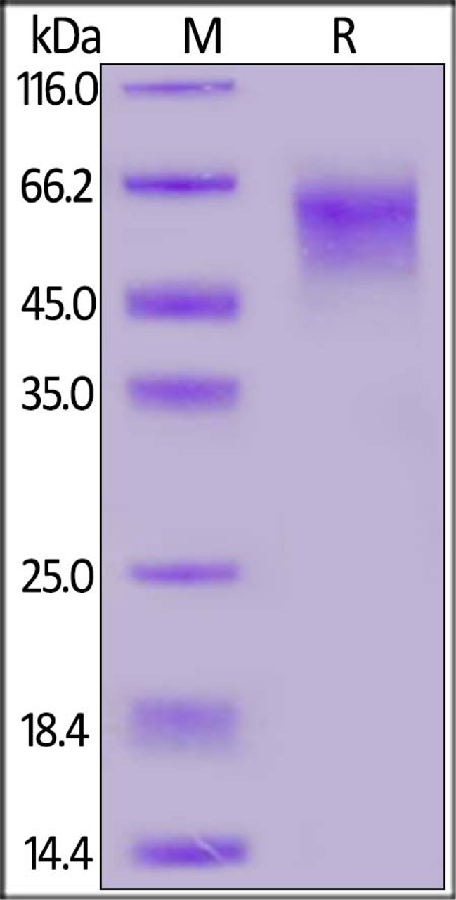 SARS-CoV-2 S1 protein NTD, His Tag on SDS-PAGE under reducing (R) condition. The gel was stained overnight with Coomassie Blue. The purity of the protein is greater than 90%.