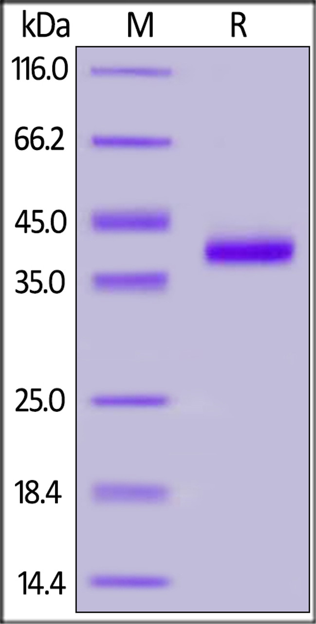 Human IL-8, Fc Tag on SDS-PAGE under reducing (R) condition. The gel was stained overnight with Coomassie Blue. The purity of the protein is greater than 95%.