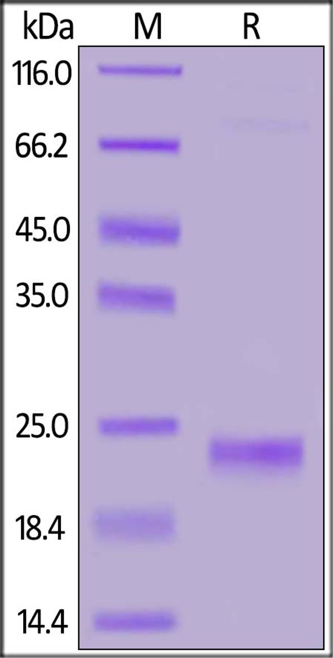 Human IL-17F, His Tag on SDS-PAGE under reducing (R) condition. The gel was stained overnight with Coomassie Blue. The purity of the protein is greater than 95%.