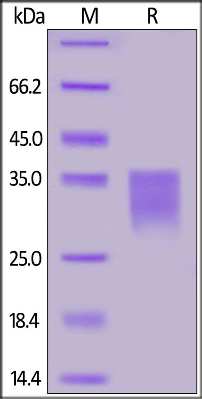 Human Her2 (498-648) , His Tag on SDS-PAGE under reducing (R) condition. The gel was stained overnight with Coomassie Blue. The purity of the protein is greater than 90%.