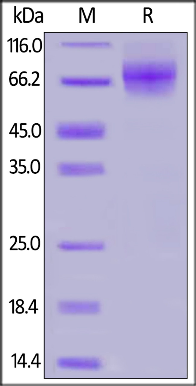 Human CD6, His Tag on SDS-PAGE under reducing (R) condition. The gel was stained overnight with Coomassie Blue. The purity of the protein is greater than 90%.